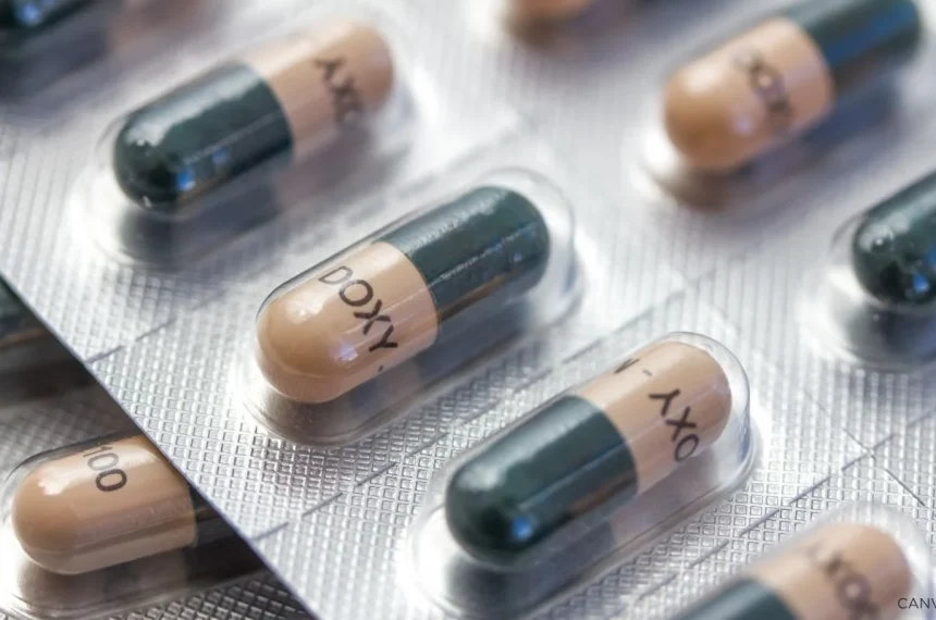 A stock image of Doxycycline capsules in silver blister packaging.
